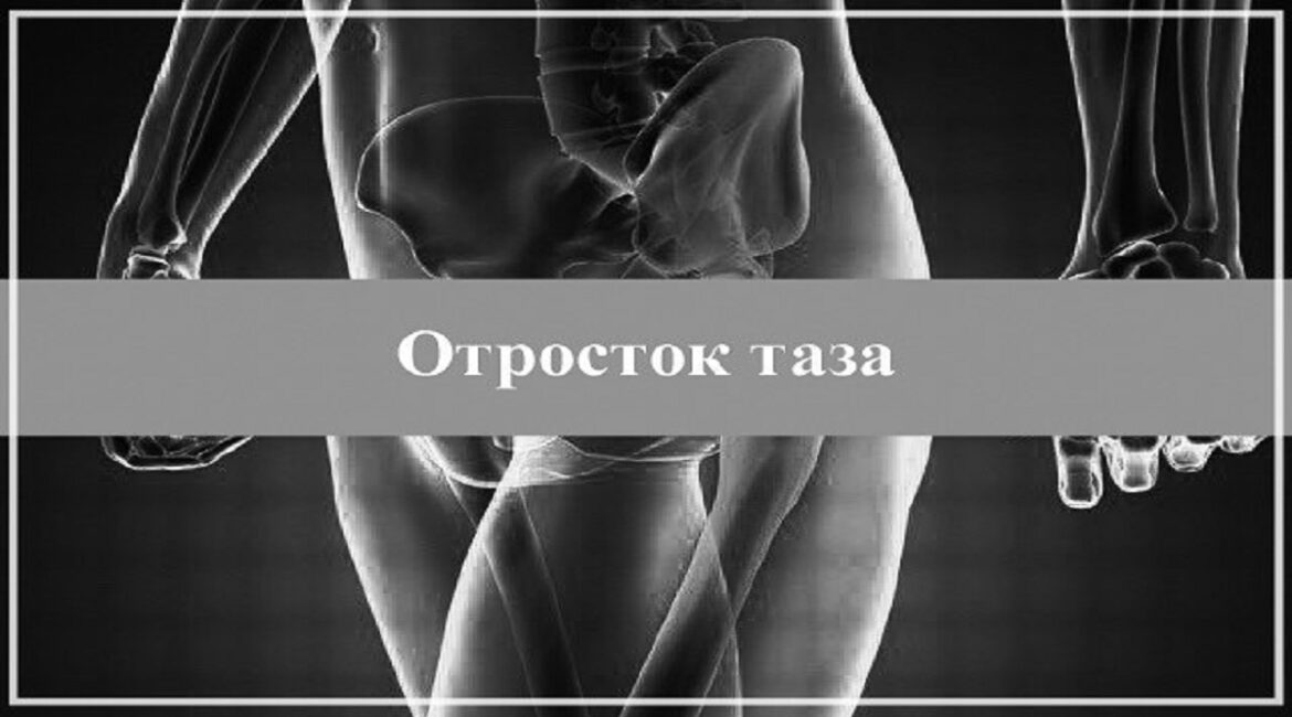 дело судмедэксперта -отросток таза